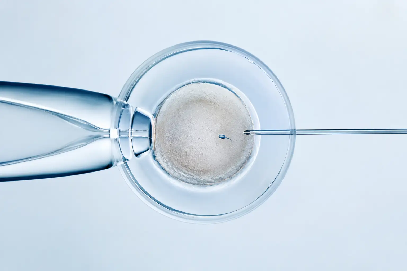 IVF/ICSI